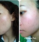 Dr.Nittaya Skin Clinic Pak Kret