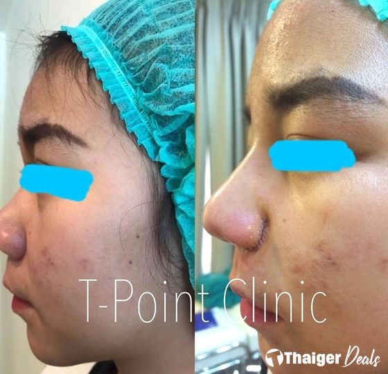 T-Point Clinic Chiang Mai