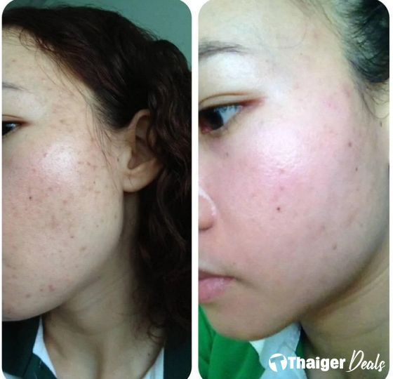 Dr.Nittaya Skin Clinic Pak Kret